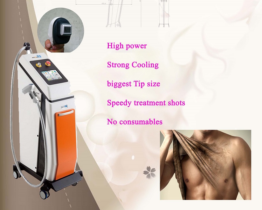 high power Diode 810nm aroma hair removal